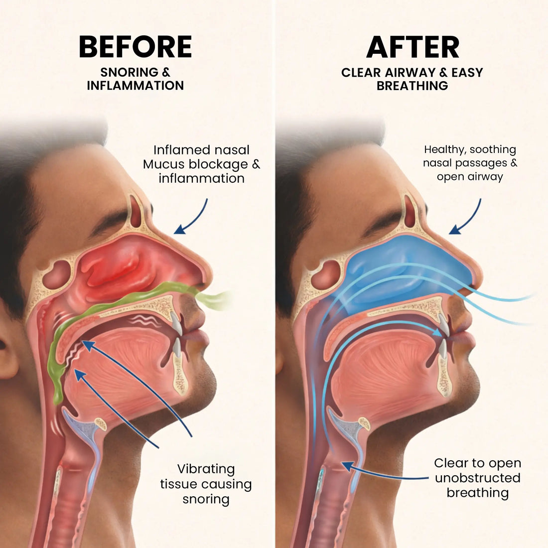 Snoring Drops 30ml - Breathe Easier, Sleep Better